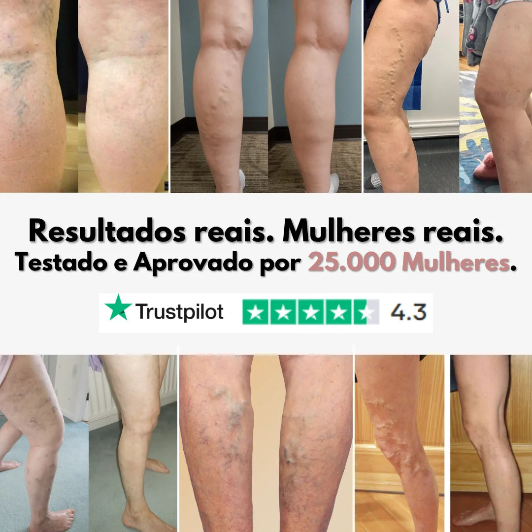 Legging Cellumove 3D – Alivie e previna as varizes de forma natural.
