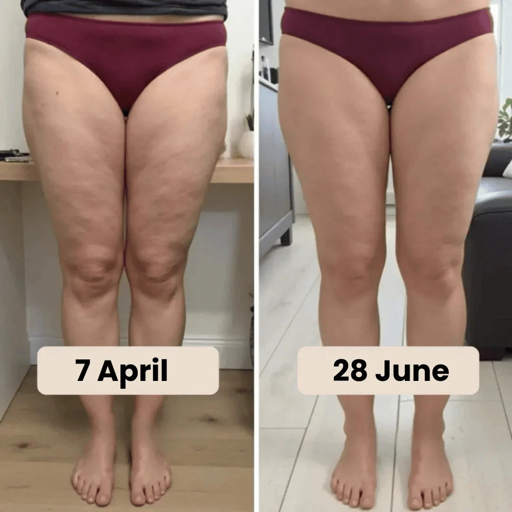 Uma legging anticelulítica para mulheres que já desejaram tudo — resultados visíveis em 14 dias