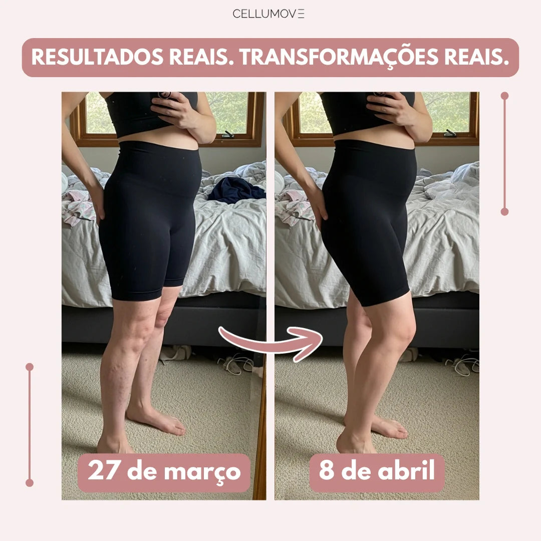 Legging Cellumove 3D – Alivie e previna as varizes de forma natural.