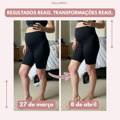 Legging Cellumove 3D – Alivie e previna as varizes de forma natural.