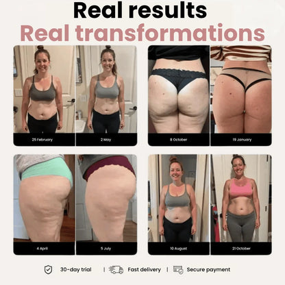 Uma legging anticelulítica para mulheres que já desejaram tudo — resultados visíveis em 14 dias