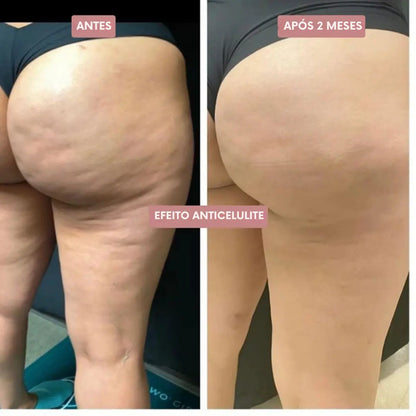 Legging Cellumove 3D – Redefina a sua silhueta sem esforço